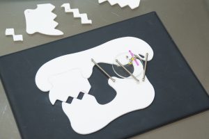 顎関節症