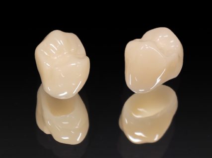 ジルコニアクラウンとは？その功罪