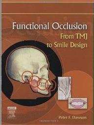 成功する噛み合わせ治療１