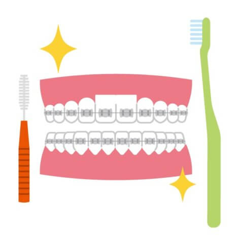 歯列矯正のよくある質問（注意点、顎関節症、歯周病、虫歯など）