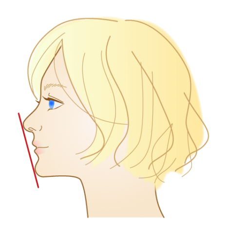 口ゴボの治し方/ワイヤー矯正,マウスピース矯正