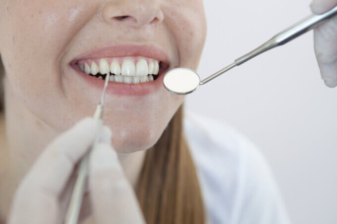 池袋 歯医者 審美歯科