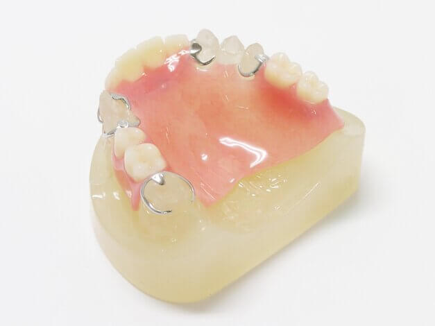 入れ歯ができるまでの期間は？完成した後の調整期間はどれぐらい？