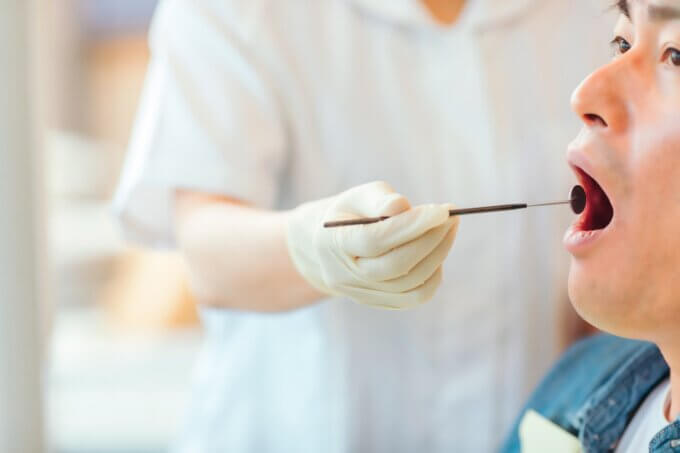 虫歯になったらブリッジ治療がいい？ブリッジ後の二次虫歯について