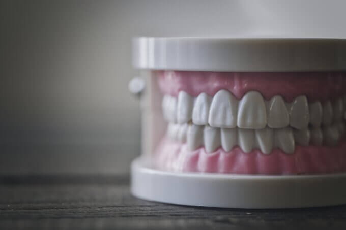 ブリッジ治療とは？歯を失った場合の治療法について【ブリッジの基礎知識】