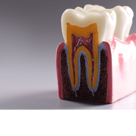 【歯周病の検査は何をするの？】