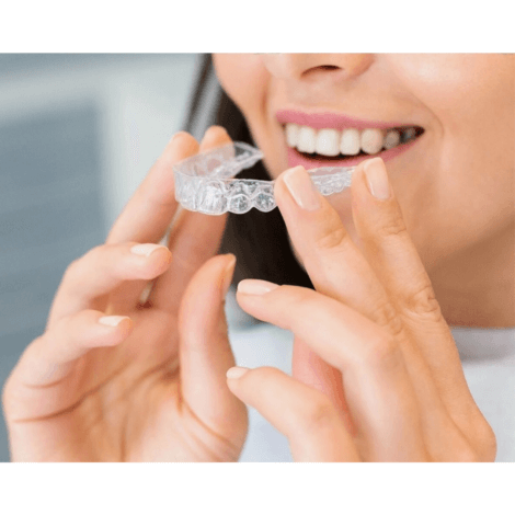 【すきっ歯はインビザラインで治療できるの？】