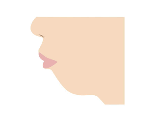 歯列矯正で口ゴボは治る？外科矯正や顎変形症について