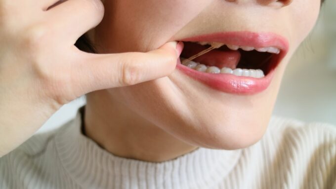 インビザラインで顎間ゴムはなぜ欠かせない？重要な役割